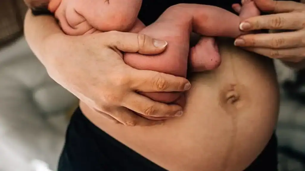 Why Is My Stomach Still Big After Pregnancy Skelmersdale?